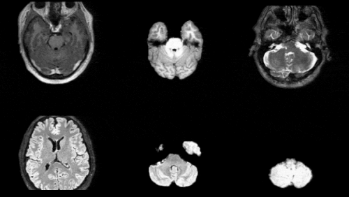 Synthesize Realistic 3D Medical Images at Scale to Ship Pre‑Trained Models