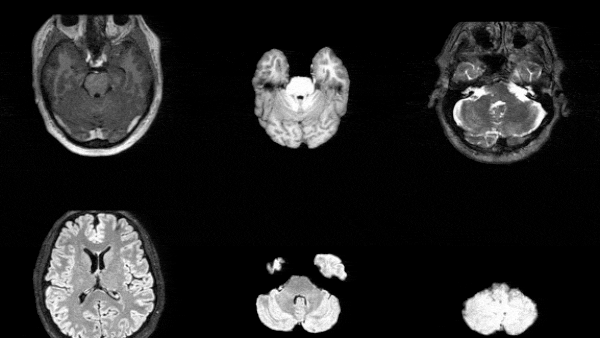 Synthesize Realistic 3D Medical Images at Scale to Ship Pre‑Trained Models — image 2